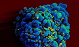 Injekcija protiv virusa HIV u eksperimentalnoj fazi