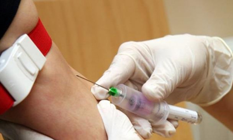 Ovaj test krvi će vam reći da li ćete umrijeti u narednih 5 godina