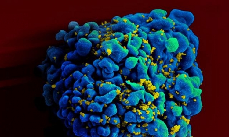 Injekcija protiv virusa HIV u eksperimentalnoj fazi