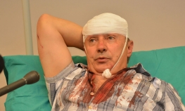 Napadač na Kukića brani se sa slobode