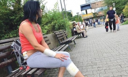 Razjareni staford izujedao Novosađanku, pa joj zadavio maltezera