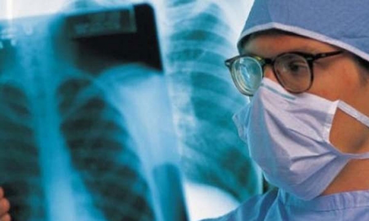 Otkrivanje tuberkuloze putem daha