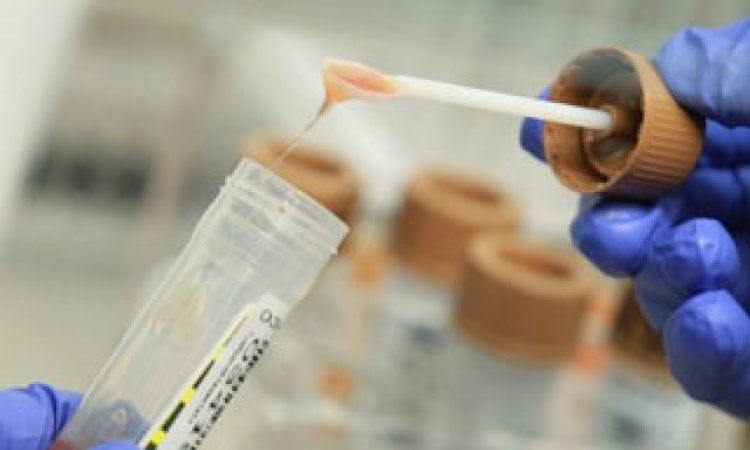 Testirati trudince na hepatitis B i C