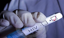 Hiljade Britanaca na HIV testu 