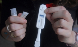 U Banjaluci besplatno testiranje na HIV
