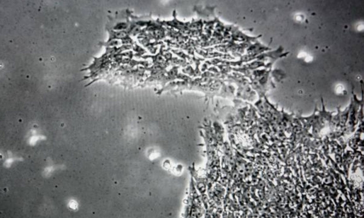Otkriven virus koji ljude čini glupljim