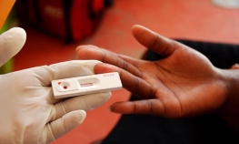 Od posljedica HIV-a umrlo 36 miliona ljudi