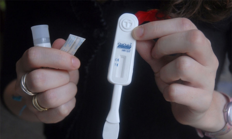 U BiH 266 zaraženih HIV-om