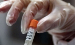 Počelo testiranje na ljudima novog lijeka protiv ebole