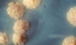 Otkriven antibiotik koji ubija i superbakterije