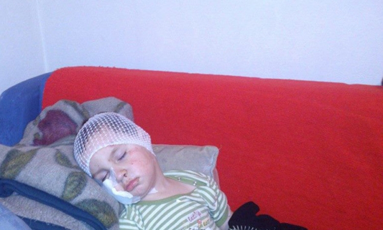Pas povrijedio trogodišnjaka