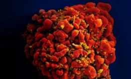 Otkriven "štit" protiv HIV?