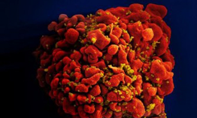 Otkriven "štit" protiv HIV?