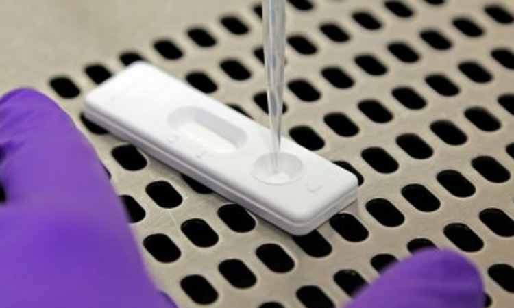 Odobren prvi brzi test za ebolu