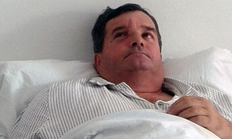 Otpušten pacijent kojem je iz glave izvađen ekser