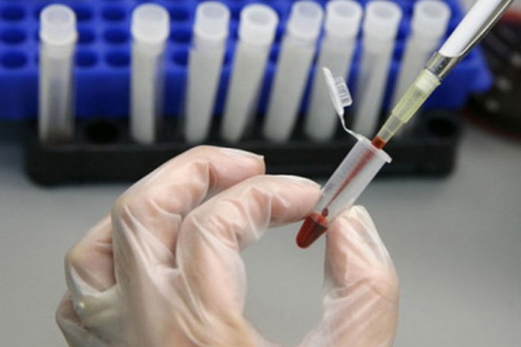 Kubanci eliminisali prenos HIV-a i sifilisa s majke na dijete
