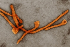 Direktorka SZO: Ebola može biti pobijeđena