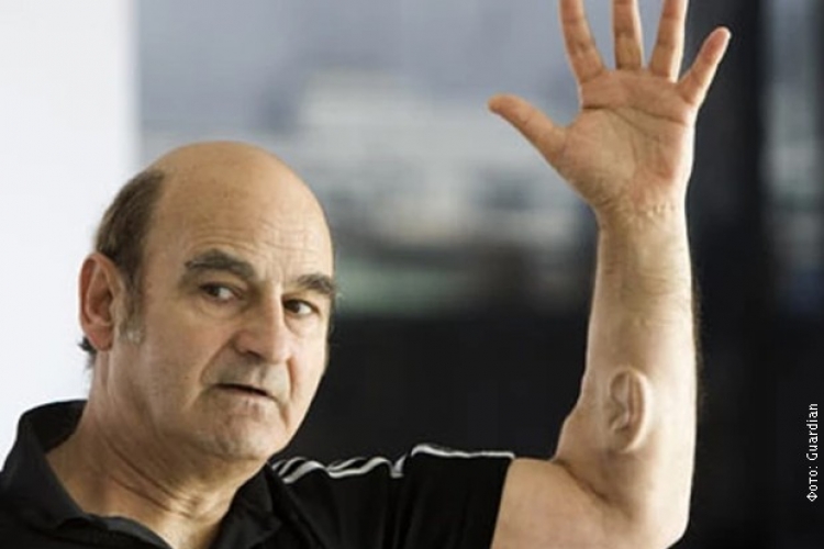 "Otkačeni" profesor uzgojio uvo na ruci (VIDEO)