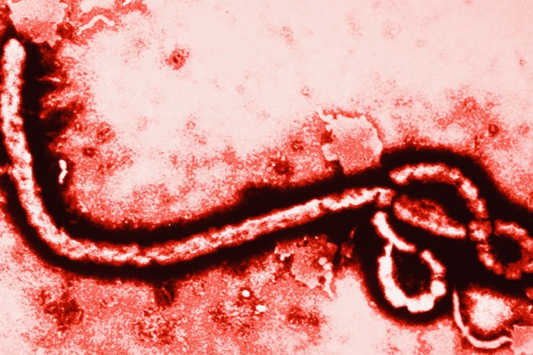 Ebola izazvala meningitis kod Kaferkijeve