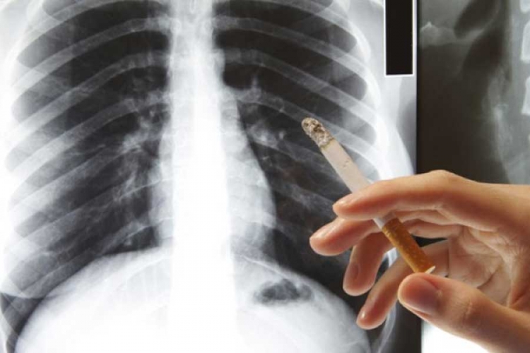 Naučnici: Ove 4 namirnice čiste pluća od nikotina
