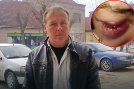 Srbija: Dječak u školi pretukao djevojčicu, glavom joj razbio arkadu