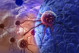 Trčanje smanjuje tumor ?