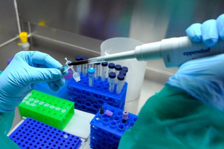 Kućni test koji će karcinom u ranoj fazi otkriti za 10 minuta