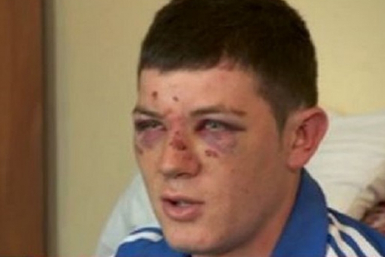 Hrvatska policija: U tuči zbog pjesme Srbin prvi počeo