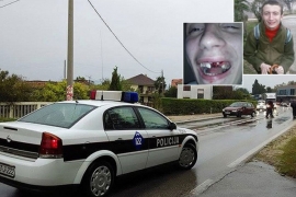 Dječak sa poteškoćama u razvoju brutalno pretučen u Mostaru
