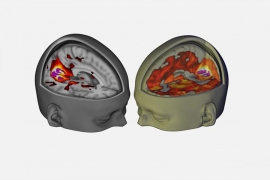 Naučnici razotkrili stanje mozga pod uticajem LSD