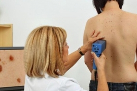 Banjaluka: Promocija kampanje "Evromelanoma"