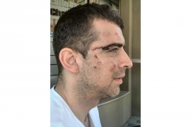 Advokat Milan Malešević brutalno pretučen tokom racije