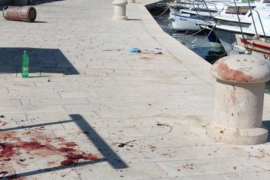 Masovna tuča u Vodicama: Mještani premlatili turiste