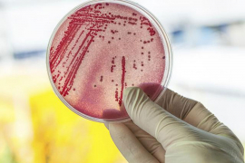 Nakon tri decenije naučnici pronašli novi antibiotik