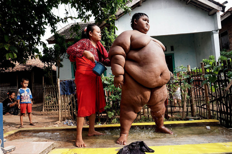 Najdeblji dječak na svijetu ima 192 kilograma (FOTO,VIDEO)