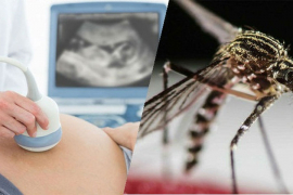 Trudnica u Austriji zaražena Zika virusom