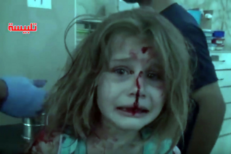 Novi uznemirujući snimak iz Sirije koji pokazuje užase rata (VIDEO)