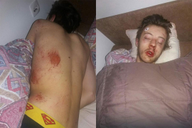 Teslić: Poznata imena nasilnika koji su brutalno pretukli mladića