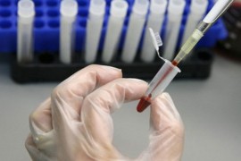 U Srpskoj 11 novootkrivenih slučajeva AIDS-a