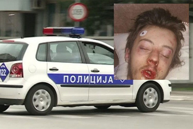 "Nezavisne" saznaju: Dva lica uhapšena zbog premlaćivanja mladog Teslićanina