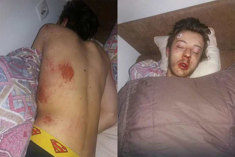 Teslić: Poznata imena nasilnika koji su brutalno pretukli mladića