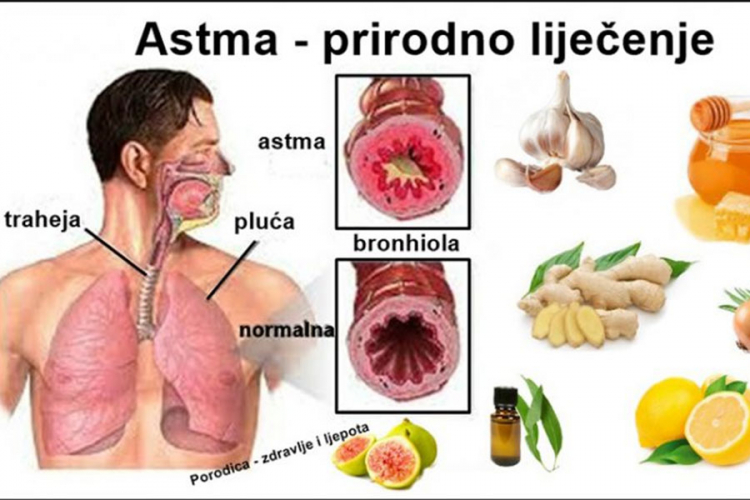 Mesne prerađevine pogoršavaju astmu