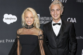 Pamela Anderson pretjerala sa operacijama?