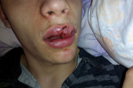 Obrt u istrazi incidenta ispred noćnog kluba "Opera" u Kozarskoj Dubici