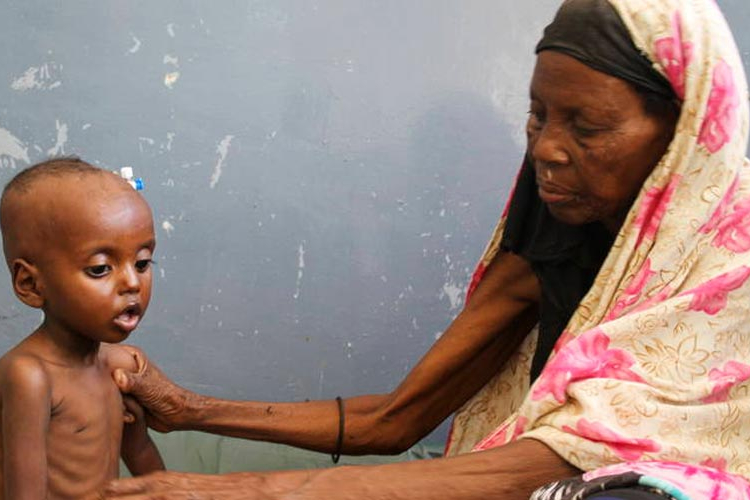 U Somaliji 110 osoba umrlo od gladi