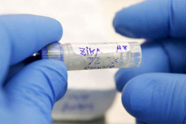 Uskoro stiže vakcina protiv zika virusa