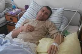 Povrijeđenom građevincu treba pomoć


