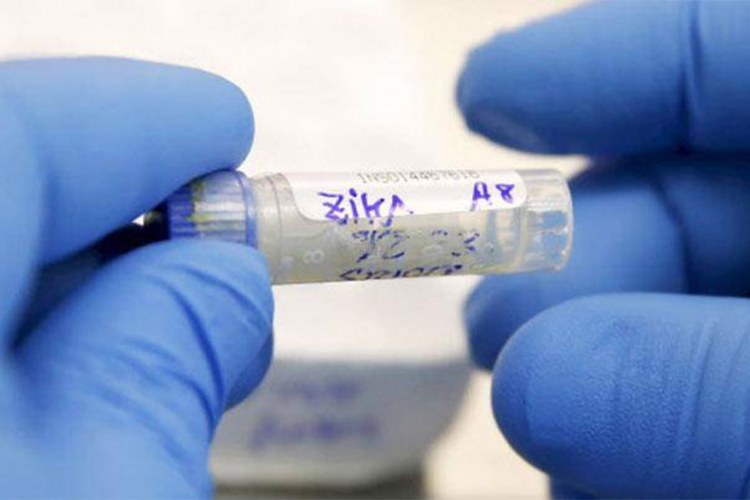 Uskoro stiže vakcina protiv zika virusa