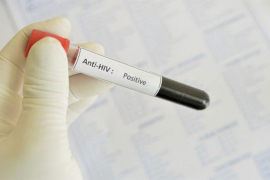 Naučnici prvi put izliječili miševe od HIV-a