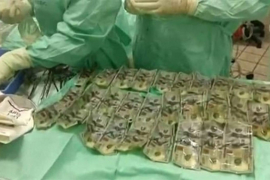 Prevarena žena progutala 7.000 dolara kako bi ih sakrila od muža